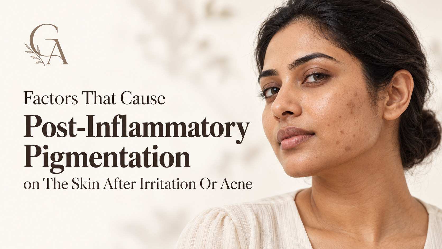 Factors That Cause Post-Inflammatory Pigmentation on The Skin After Irritation Or Acne